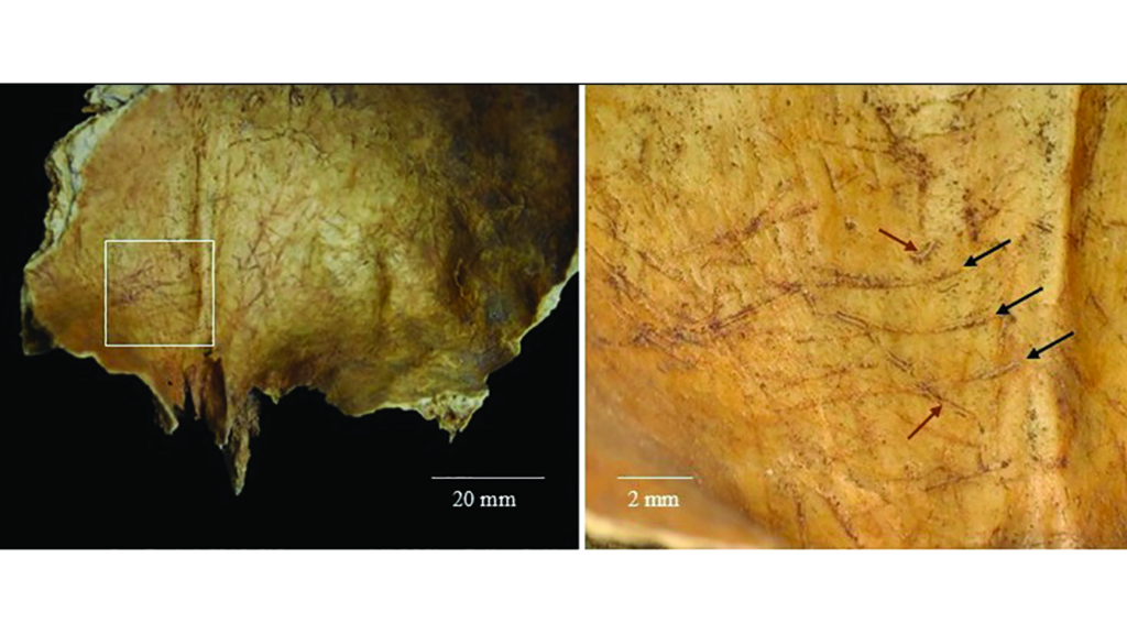 2,000 years ago in Scotland, people removed a corpse’s brain and fashioned the arm bones into tools